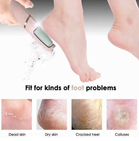 Electric Foot Callus Remover